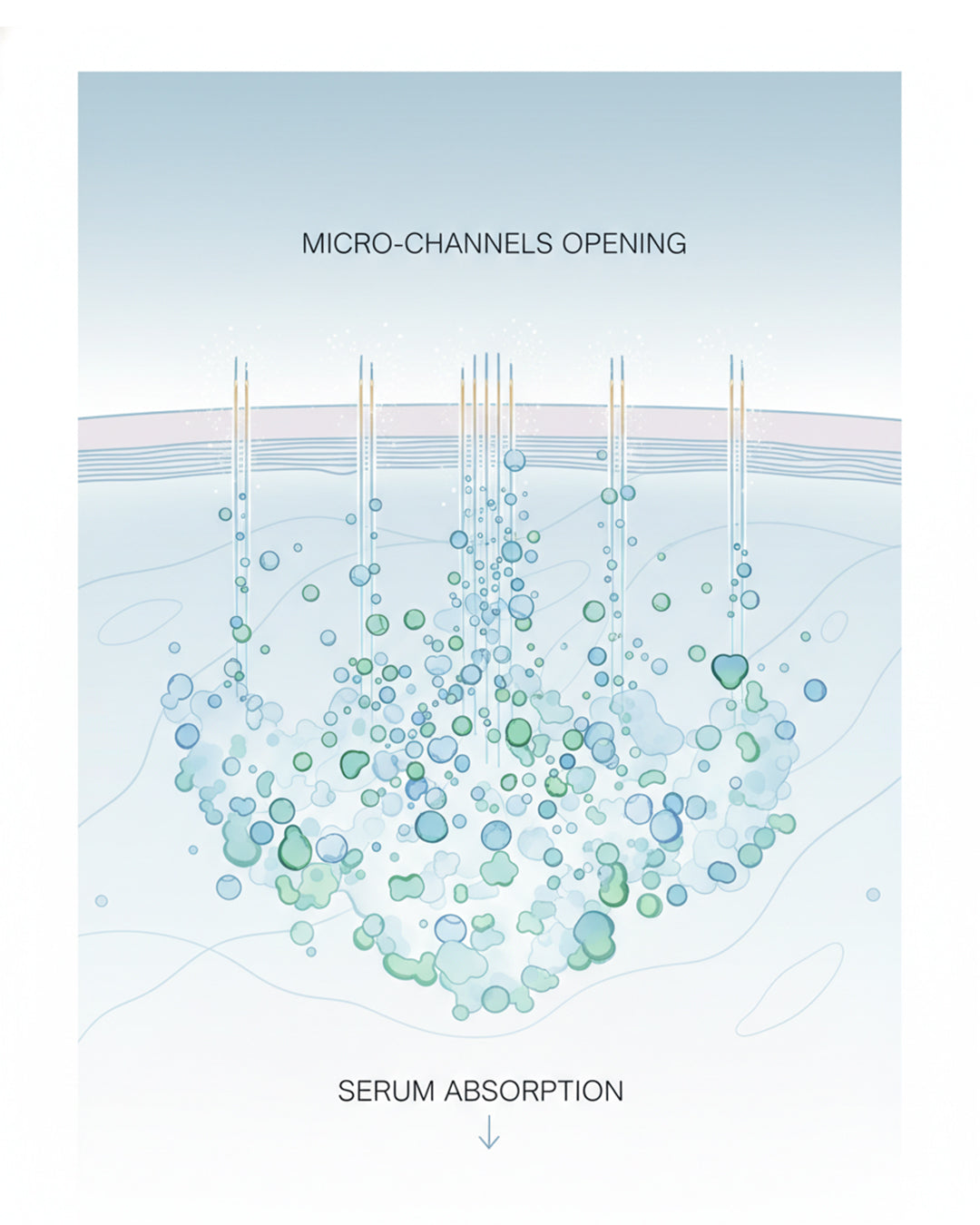 Illustration showing micro-channels opening for serum absorption using the ROLLER Titanium Dermaroller.