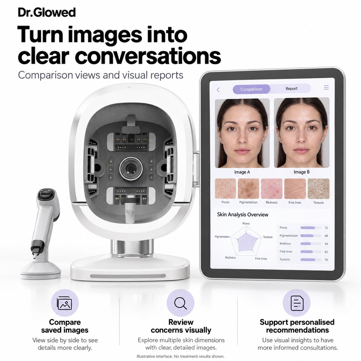 Skin Analyzer No. 1