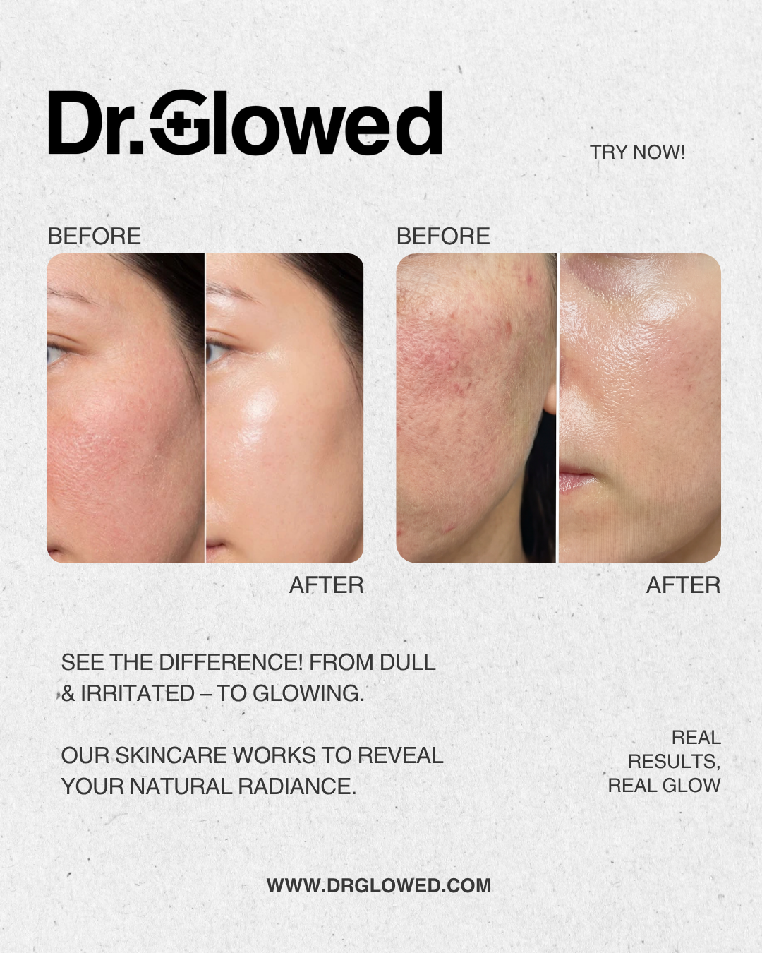 STARDUST Regenerative PDRN & Exosomes Face Serum Box