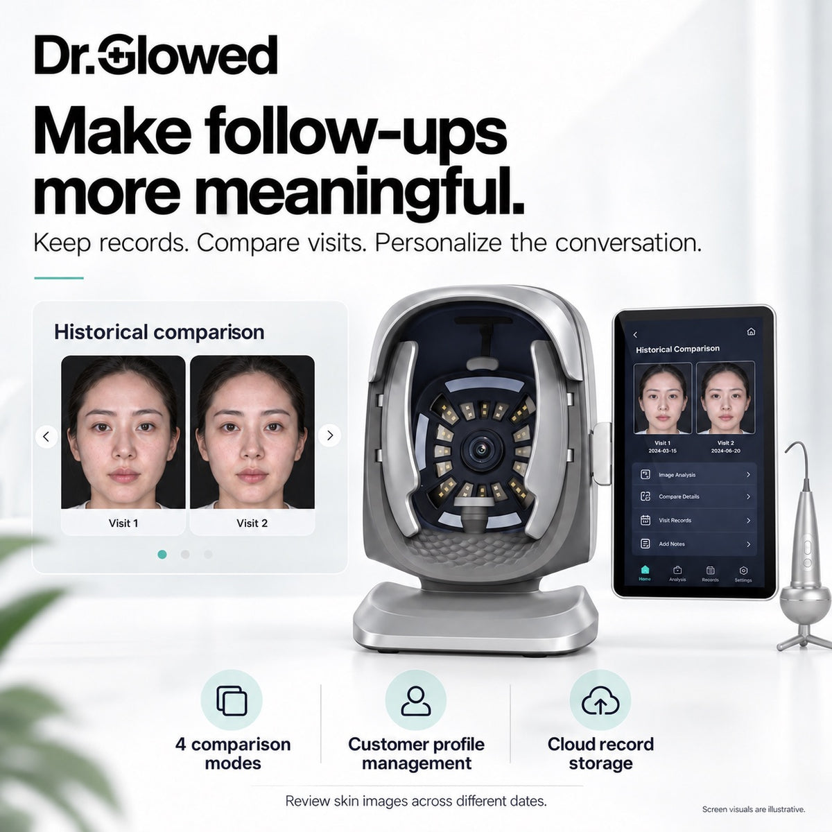 Skin and Scalp Analyzer No. 4